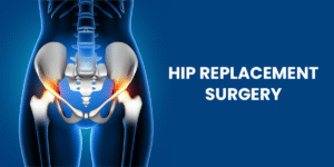 Hip replacement surgery in Agartala